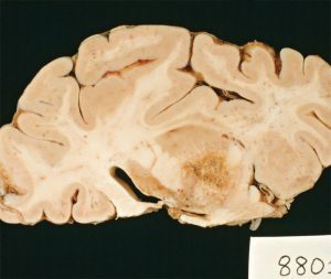 parazit-creier-stiinta-tehnica-9