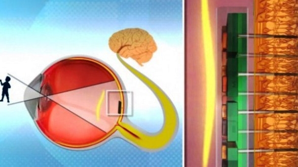 picături pentru ochi pentru tratarea vederii rețete de afine pentru a îmbunătăți vederea