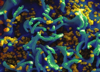 Celula-T-infectata-cu-HIV