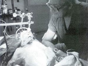transplantul-de-cap---stiinta-tehnica-5