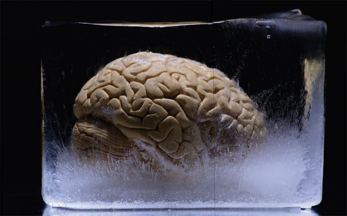creier-criogenie-stiinta-tehnica-1