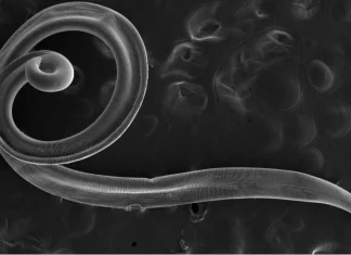 Când paraziți se instalează sub pleoapă: un caz medical rar 5 (5)