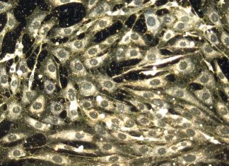 Nanoparticulele: O Nouă Speranță în Tratamentul Cancerului Fără Afectarea Celulelor Sănătoase 0 (0)