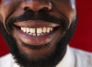 Descoperire Uimitoare în Gura Noastră: Structuri ADN Gigantice cu Impact Asupra Imunității 0 (0)