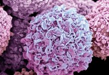 Dimensiunea Corporală în Preajma Pubertății și Riscul de Cancer la Sân în Anii de Fertilitate