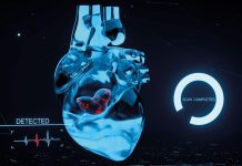 Metodă Neinvazivă Promițătoare Ar Putea Înlocui Cateterizarea în Diagnosticarea Insuficienței Cardiace