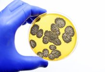 Biomarkerul Sanguin Care Prevestește Infecțiile Fungice Grave