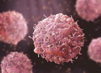 Harta Evoluției Cancerului Prin Studiul Cromozomilor 5 (1)