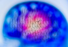 Stimularea Cerebrală Poate Evalua Progresia Bolii Alzheimer