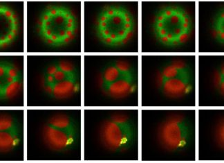 Cum Folosește Bacteria Tuberculozei Lipidele pentru a Manipula Celulele Imunitare 5 (1)