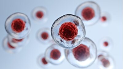 Gelatinous-stem-cells-400x225