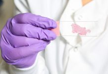 Codurile Genetice Dezvăluie Complexitatea Tumorilor Canceroase