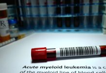 Noua Tehnologie Genomică Revoluționează Diagnosticarea Leucemiei Acute