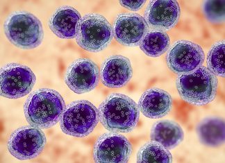 Biopsia Lichidă: Speranță Nouă pentru Diagnosticarea Rapidă a Limfomului Burkitt în Africa Subsahariană 0 (0)