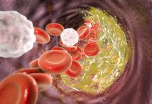 Legătura dintre Compunerea Microbiomului Intestinal și Riscul de Dislipidemie