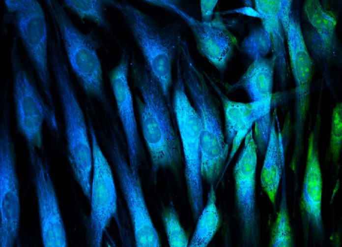 Fibroblasts2-509419560-1024x739