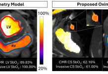 Noua Tehnică MRI Evaluează Rapid Consumul de Oxigen al Inimii