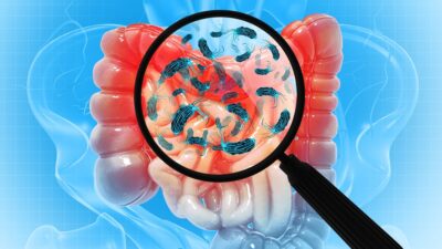 Finding-gut-bacteria-400x225