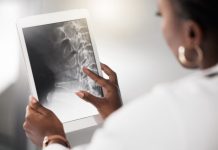 Descoperirea Legăturii dintre Sănătatea Cardiacă și Riscul de Fracturi Osteoporotice la Femeile Postmenopauză