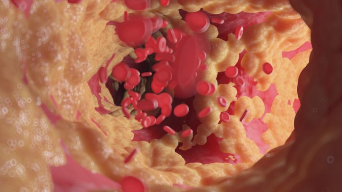 GettyImages-1386002223