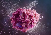 Noua Strategie în Imunoterapia Cancerului Pulmonar: Macrofagele Modificate Genetic Arată Eficacitate Împotriva Metastazelor Cerebrale