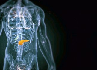 Biomarkerii HRD în Cancerul Pancreatic Metastatic Deschid Calea către Imunoterapia de Precizie 0 (0)