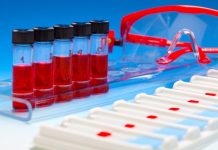 Testul de detectare a ADN-ului tumoral circulant ar putea optimiza tratamentul cancerului de sân la femeile în vârstă