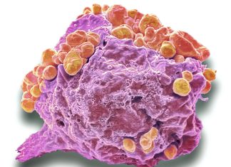 Avans în Imunoterapia Limfomului T: Strategia Duală a Vaccinurilor cu ADN Sintetic 0 (0)