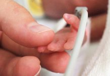 Suplimentele cu Probiotice ce Conțin Clostridium Butyricum ar Putea Reduce Riscul Recurenței Nașterilor Premature