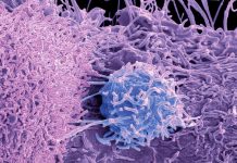 Descoperire Revoluționară în Biologia Celulară: Mecanismul de Transport al Proteinelor și Legătura cu Migrația Celulelor Canceroase