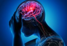 Unelte AI Reduc Riscul Evenimentelor Vasculare După Accidentul Vascular Cerebral cu 27%