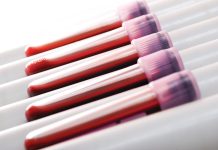 Fragmentele de ADN din Sânge: Un Indicator Promițător pentru Diverse Boli