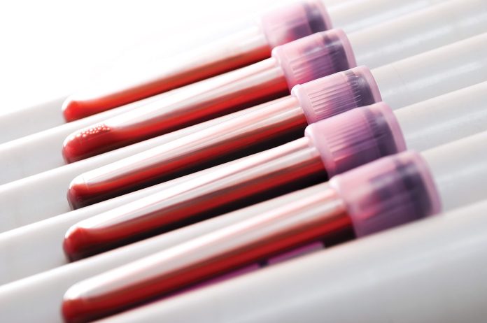 TwistBioscience_Feb1_2023_GettyImages_171367478_BloodSamples