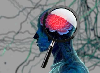 Anemia Ar Putea Fi un Factor de Risc Modificabil pentru Boala Alzheimer 0 (0)