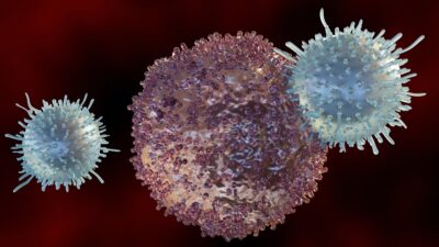 Active-immune-cells-400x225