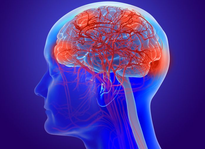 Alzheimers-Dimentia-1125868862-e1647875493579