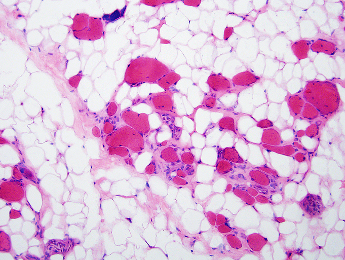 GettyImages-1134491944