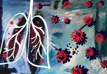 Descoperirea Mecanismului Metabolic Care Conferă Rezistență la Radiații în Cancerul Pulmonar