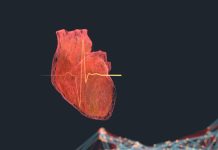 FDA Aprobă Primul Algoritm AI pentru Diagnosticarea Amiloidozei Cardiace