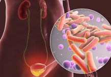 Test Rapid de Urină Identifică Antibioticul Potrivit pentru Infecțiile Urinare în Câteva Ore