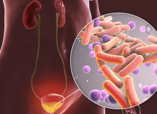 Test Rapid de Urină Identifică Antibioticul Potrivit pentru Infecțiile Urinare în Câteva Ore 0 (0)