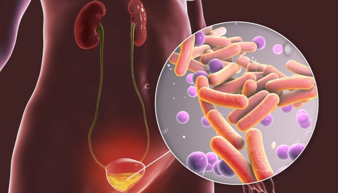 GettyImages-1336047273-scaled-e1774982047800