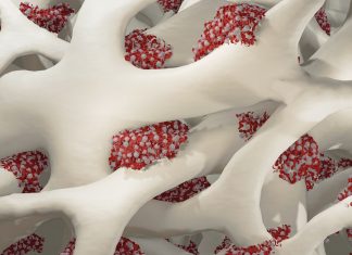 Inhibitorii PD-L1 în Tratamentul Cancerului Ar Putea Fi Utilizați pentru Combaterea Pierderii Osoase în Obezitate 0 (0)