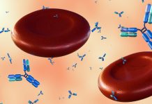 Terapia Revoluționară cu Celule CAR T Marchează o Vindecare Spectaculoasă în Cazul unei Boli Autoimune Grave