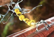 Lupta pentru Viață: Cum Poate Salva Screening-ul Neonatal la Naștere Copiii din Toată Țara