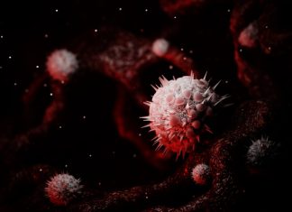 Noi strategii în tratamentul cancerului de gât asociat cu HPV 0 (0)