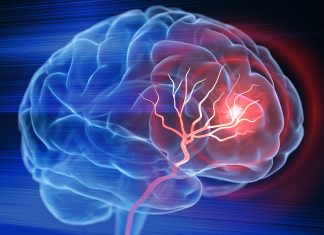 Greutatea Redusă la Naștere Poate Crește Riscul de Accident Vascular Cerebral în Tinerete 0 (0)