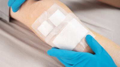 Wound-healing-400x225