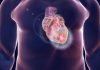 Subprodusul unui infarct poate declanșa inflamații cerebrale și declin cognitiv