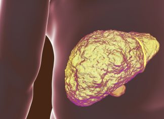 Terapia celulară ar putea reduce necesitatea transplantului hepatic în cazuri avansate de ciroză 5 (1)
